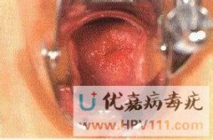 <b>ꎵLһǼJ</b>