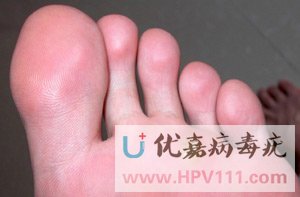 ДȾԴ 翵