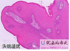 Jz鷽Щ